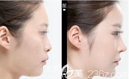 吳禮誠<span style=