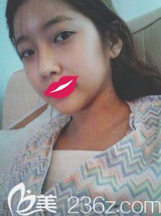 在秦皇島念奴嬌剛做完隆胸術(shù)后有點(diǎn)腫脹 在秦皇島念奴嬌剛做完隆胸術(shù)后有點(diǎn)腫脹