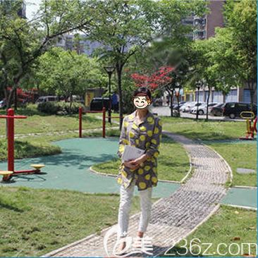 做完假體隆胸手術(shù)7天恢復(fù)照 做完假體隆胸手術(shù)7天恢復(fù)照