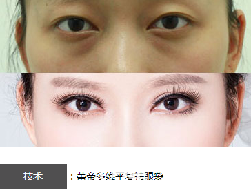 20190124_1548321959775379.png image.png