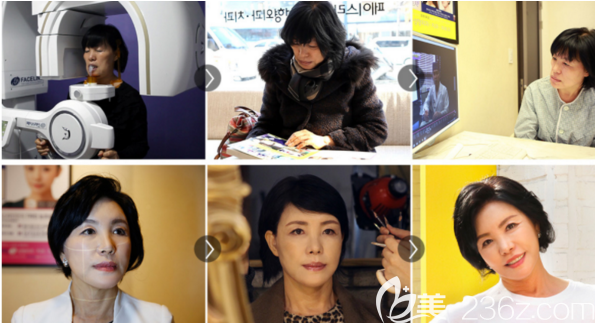 手術(shù)前的宋志英 手術(shù)前的宋志英