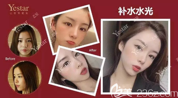 重慶藝星整形案例