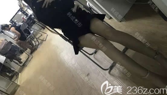 我在南寧韓成整形做腿部吸脂第30天 我在南寧韓成整形做腿部吸脂第30天