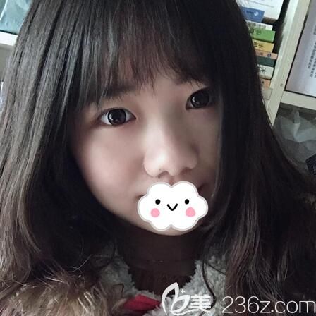 綜合隆鼻術(shù)前照片 綜合隆鼻術(shù)前照片