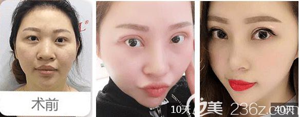 常州美貝爾眼鼻綜合恢復<span style=