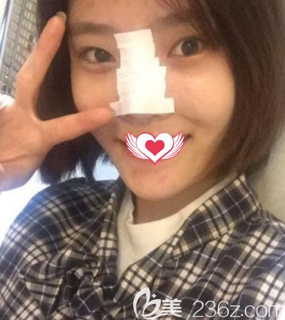 在<!--<i data=20240703-sp></i>-->做隆鼻術(shù)后鼻子微腫 在<!--<i data=20240703-sp></i>-->做隆鼻術(shù)后鼻子微腫