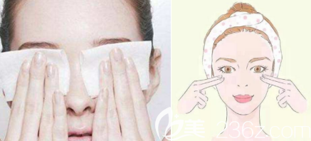 雙眼皮術(shù)后按壓和冰敷是一定要的