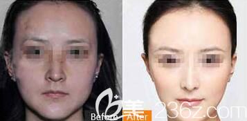 無錫施爾美水光煥顏