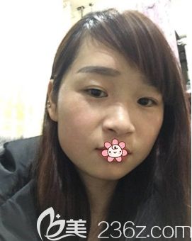 重慶藝星整形祛斑怎么樣