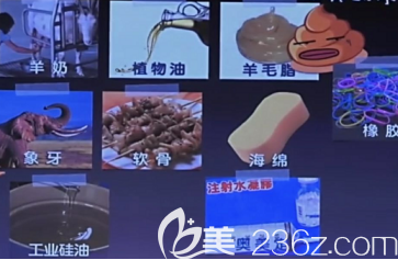 很早以前使用的假體隆胸材料