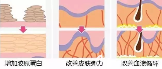 貴陽華美線雕效果持久