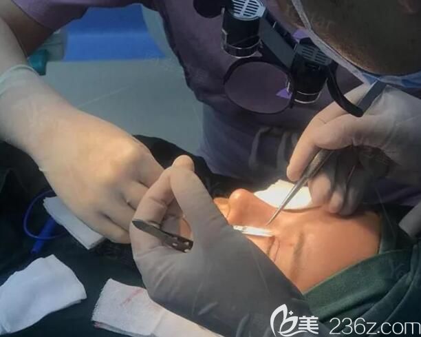 汪樹杰主任做雙眼皮失敗修復手術