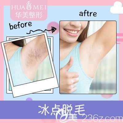 汕頭華美冰點(diǎn)脫毛案例