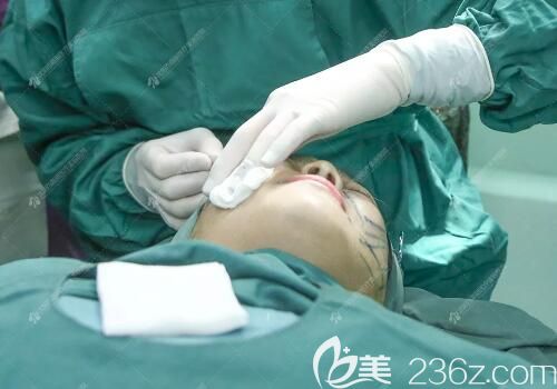 做線雕手術(shù)過(guò)程中