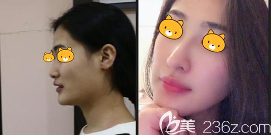 羅志敏<span style=