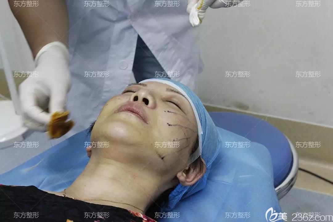 我在南寧東方整形做全臉埋線提升手術(shù)中 我在南寧東方整形做全臉埋線提升手術(shù)中