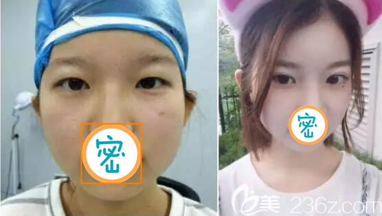 元宵佳節(jié)前揭秘樂(lè)山達(dá)芬奇整形美容醫(yī)院2019年全新整形價(jià)格表以及整形案例