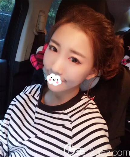 在內(nèi)江達(dá)芬奇嘗試了閨蜜推薦的全臉脂肪填充手術(shù)，果然擺脫了面部凹陷的大媽臉