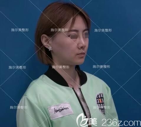 面診江蘇施爾美術(shù)前面部初老 面診江蘇施爾美術(shù)前面部初老