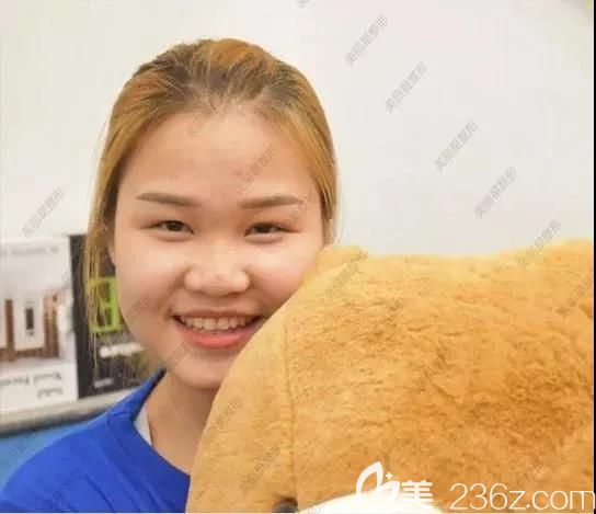 我在南寧美麗星整形做眼鼻部綜合整形前的照片 我在南寧美麗星整形做眼鼻部綜合整形前的照片