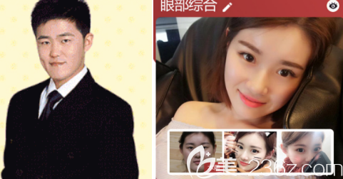 濟(jì)南美蓮雙眼皮案例