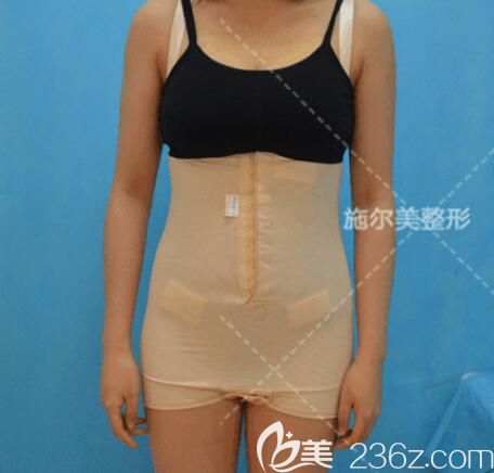 剛做完腰腹部吸脂術(shù)后穿戴塑身衣