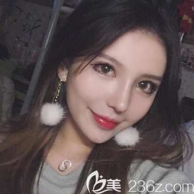 廣州藝美李闖做隆鼻和脂肪填充怎么樣