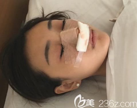 寧波薇琳醫(yī)院做隆鼻即刻<span style= 寧波薇琳醫(yī)院做隆鼻即刻<span style=