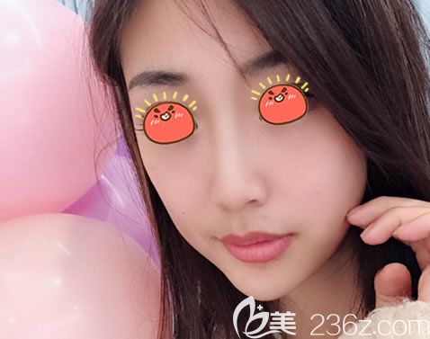 寧波薇琳<!--<i data=20240703-sp></i>-->假體隆鼻<span style= 寧波薇琳<!--<i data=20240703-sp></i>-->假體隆鼻<span style=