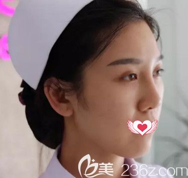 邯鄲京美采用自體耳軟骨隆鼻術(shù)讓短鼻梁、大鼻頭的我擁有高挺自然鼻