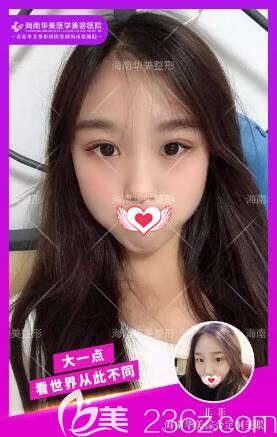 華美精雕電眼真人案例對比