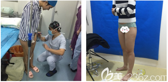 去廣州藝美做大腿吸脂術(shù)前照片 去廣州藝美做大腿吸脂術(shù)前照片