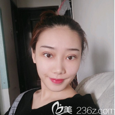 汕頭華美做雙眼皮怎么樣