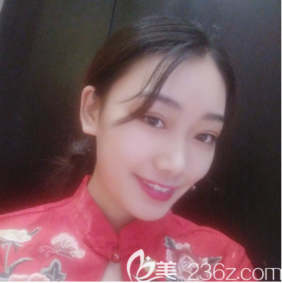 汕頭華美雙眼皮真人案例