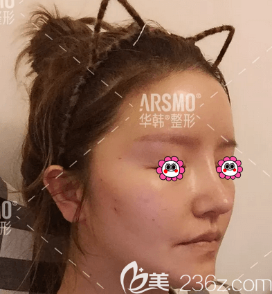 左日宜和陳敏院長給我做6D鉆石<span style=