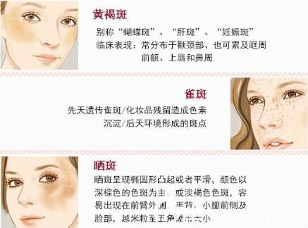 白瓷娃娃收費貴嗎？