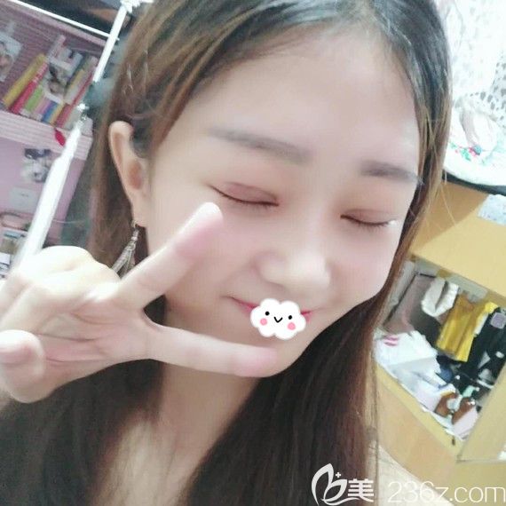 雙眼皮術(shù)后疤痕恢復(fù)效果