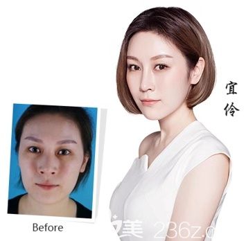 貴陽華美隆鼻怎么樣