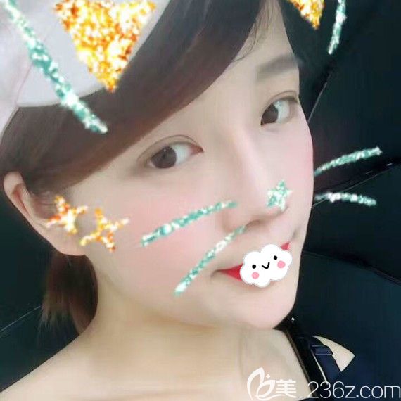 黃石中愛萬文勇隆鼻好嗎？自體軟骨隆鼻案例見分曉