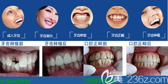 唯美口腔特色診療技術(shù)