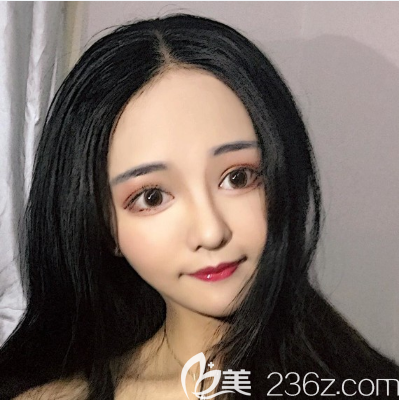 廣州美恩陳宏彬做隆鼻怎么樣 廣州美恩陳宏彬做隆鼻怎么樣