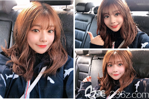 廣州美恩陳宏彬做脂肪填充怎么樣 廣州美恩陳宏彬做脂肪填充怎么樣