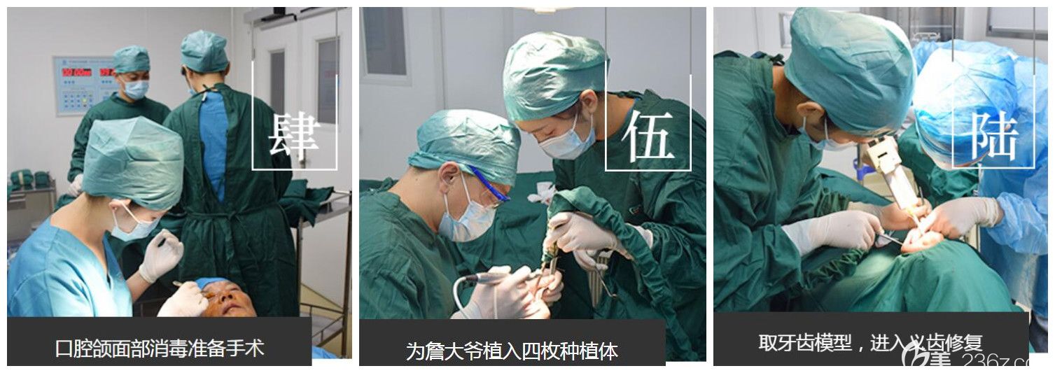 60對(duì)老人消毒后進(jìn)入手術(shù)室進(jìn)行種植牙手術(shù) 60對(duì)老人消毒后進(jìn)入手術(shù)室進(jìn)行種植牙手術(shù)