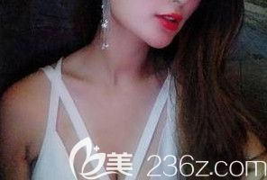 南云醫(yī)院做的自體脂肪豐胸49天的時(shí)候 南云醫(yī)院做的自體脂肪豐胸49天的時(shí)候