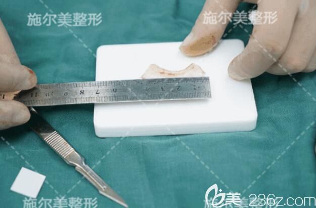 取出來的肋軟骨醫(yī)生正在雕刻 取出來的肋軟骨醫(yī)生正在雕刻