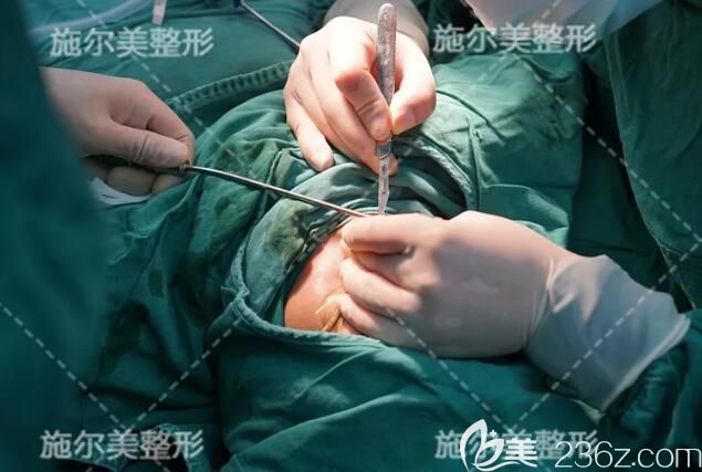 醫(yī)生將雕刻好的肋軟骨放置在鼻中 醫(yī)生將雕刻好的肋軟骨放置在鼻中