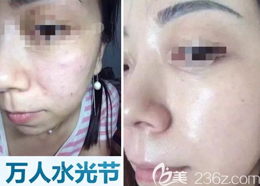 嘉興禾美整形醫(yī)院案例