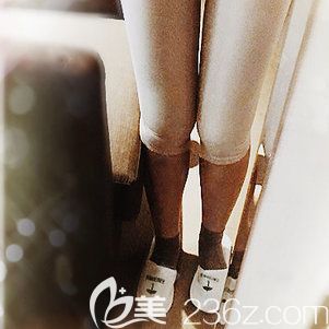 <!--<i data=20240703-sp></i>-->吸脂瘦大腿7天 <!--<i data=20240703-sp></i>-->吸脂瘦大腿7天