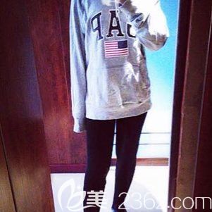 我選擇徐志剛做吸脂瘦大腿一個月案例，附醫(yī)院吸脂價(jià)格表