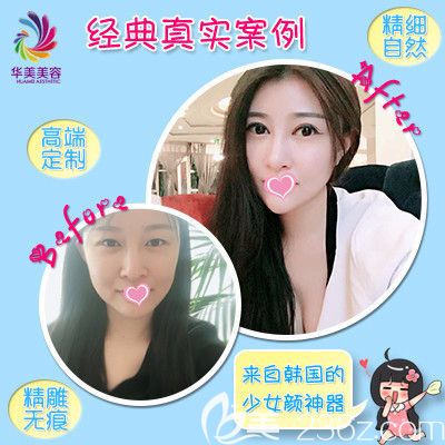 3月女人節(jié)邯鄲華美推出一大波整形優(yōu)惠活動 雙眼皮專享價(jià)為1680元